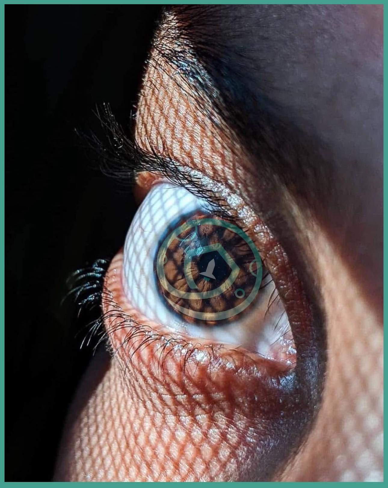 Eye of SFM